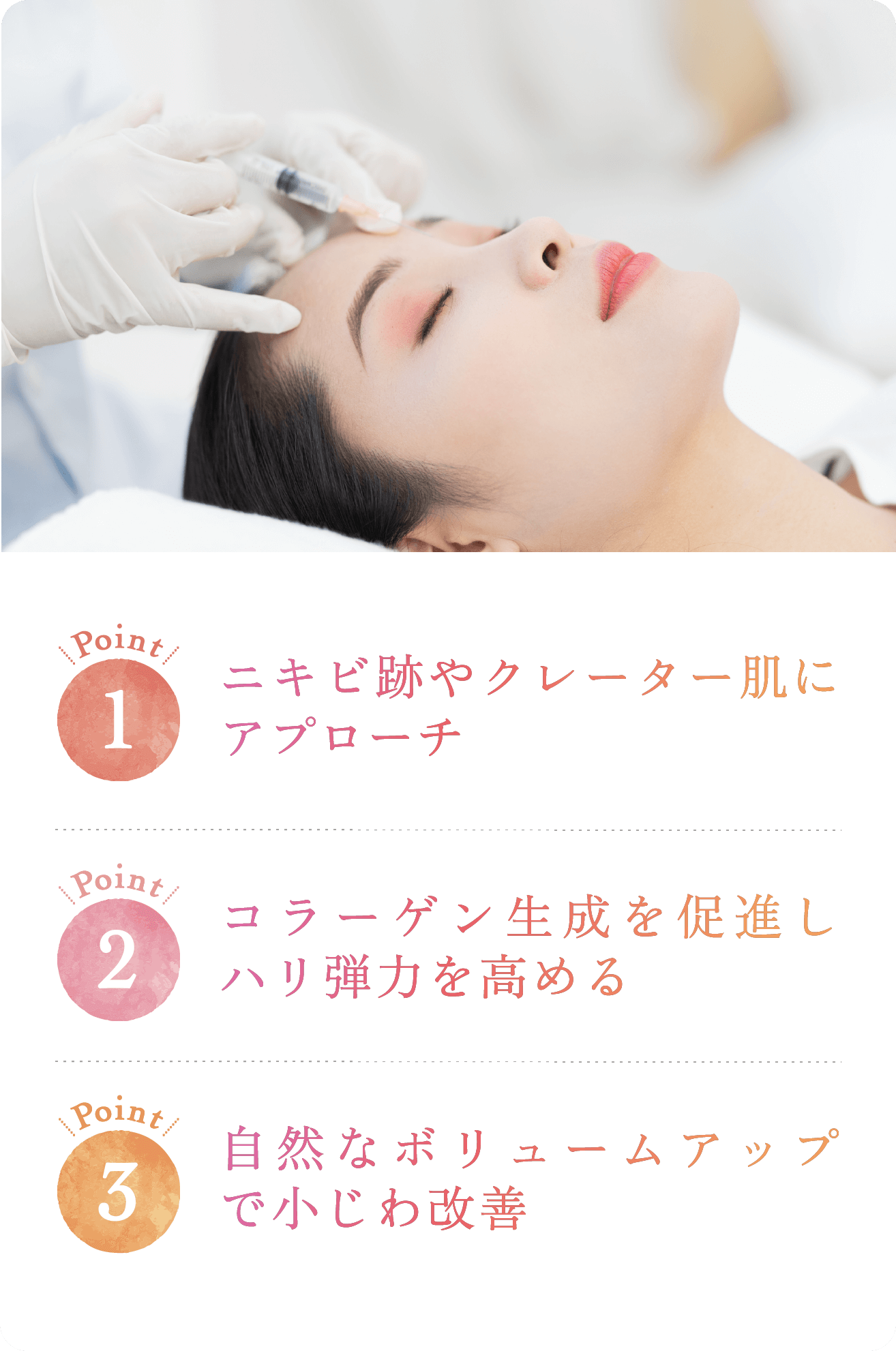 point1.ニキビ跡やクレーター肌にアプローチ point2.コラーゲン生成を促進しハリ弾力を高める point3.自然なボリュームアップで小じわ改善