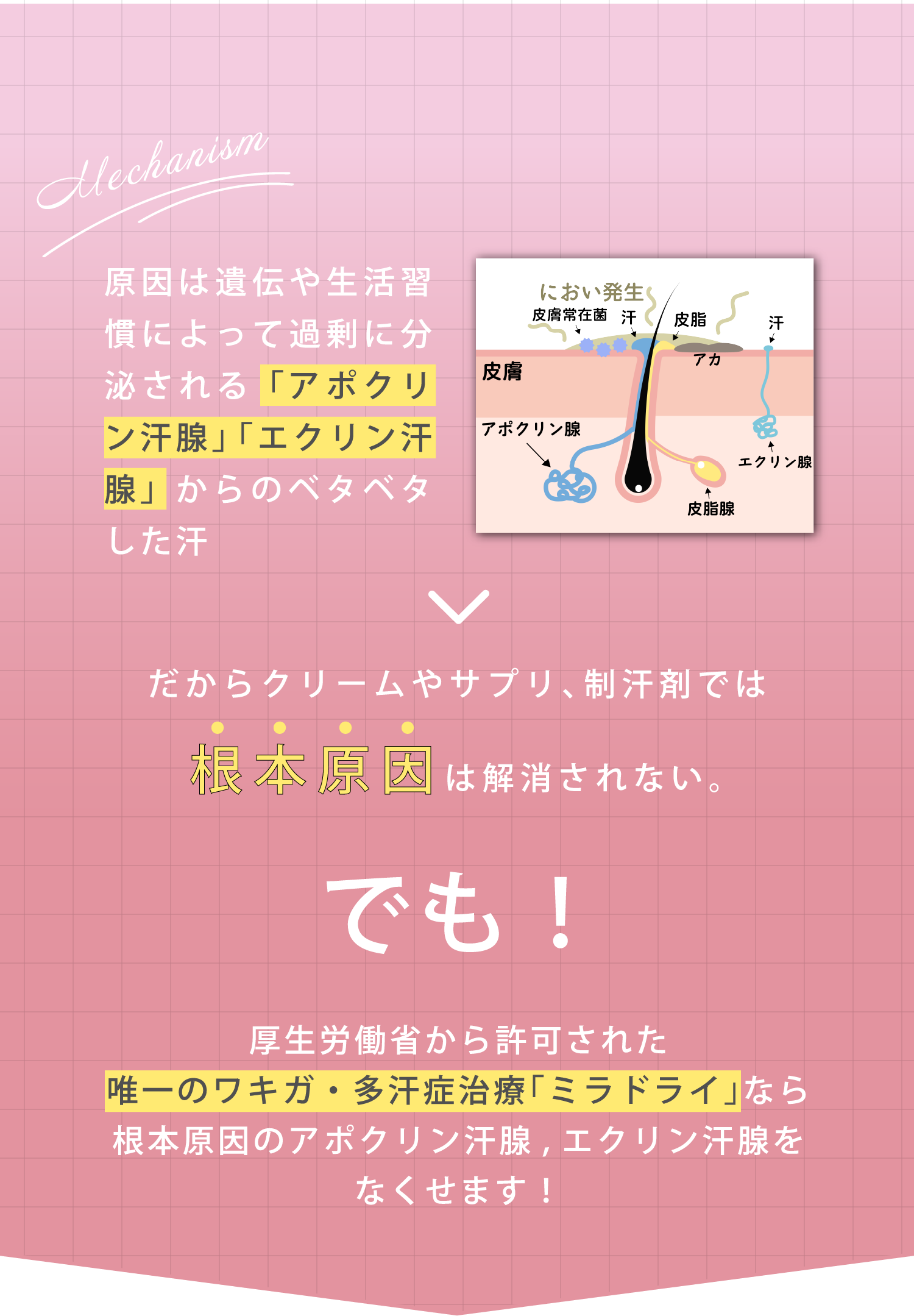 原因は遺伝や生活習慣によって過剰に分泌される「アポクリン汗腺」「エクリン汗腺」からのべたべたした汗→だからクリームやサプリ、制汗剤では根本原因は解消されない。でも！厚生労働省から許可された唯一のワキガ・多汗症治療「ミラドライ」なら根本原因のアポクリン汗腺、エクリン汗腺をなくせます！